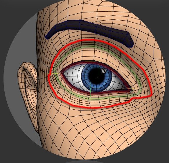 Droopy eyelid area shown around the upper and lower eyelid region.